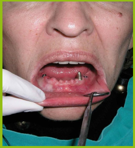 dentista milano costi