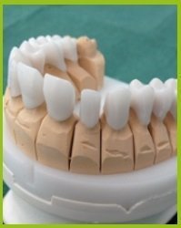 protesi dentali milano